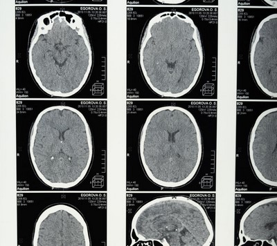 Neurology & Migraine Specialist
