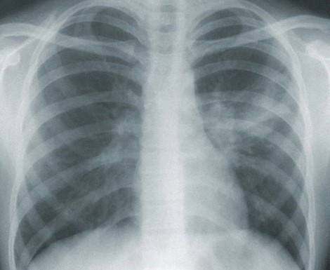 Radiology