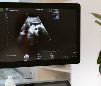 4D Ultrasound